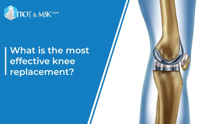 What is the most effective knee replacement?