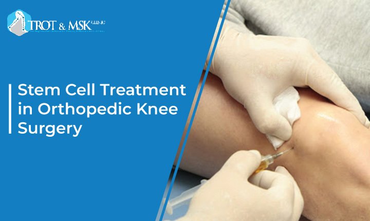 Stem Cell Treatment in Orthopedic Knee Surgery