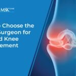 HOW TO CHOOSE THE RIGHT SURGEON FOR HIP AND KNEE REPLACEMENT