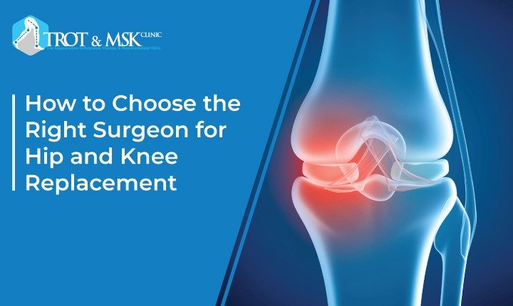 HOW TO CHOOSE THE RIGHT SURGEON FOR HIP AND KNEE REPLACEMENT